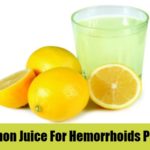 natural remedies for hemorrhoids